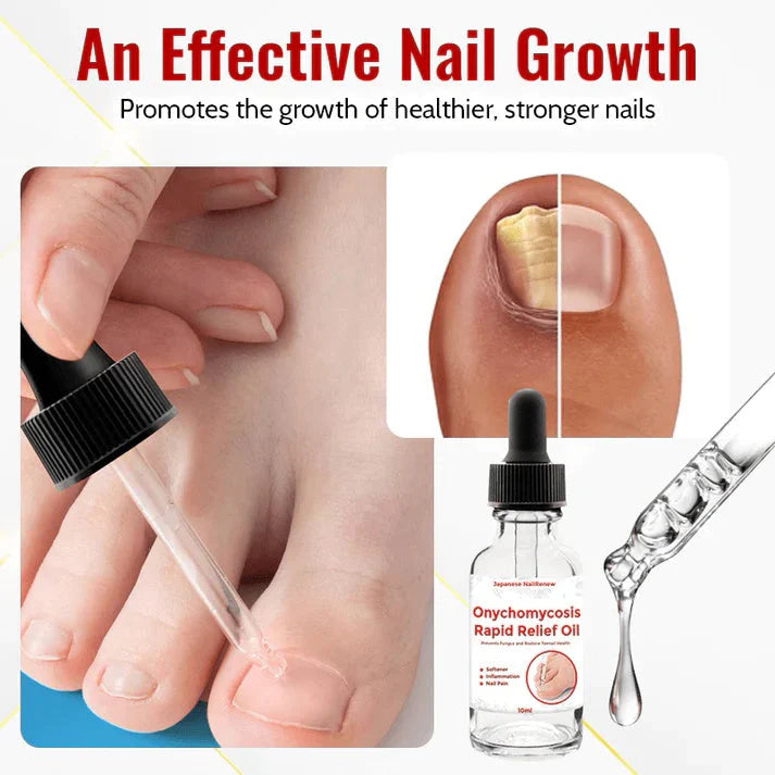 Japanese NailViva Onychomycosis Rapid Relief Oil