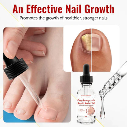 Japanese NailViva Onychomycosis Rapid Relief Oil