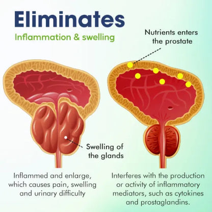 Prostate Treatment Drops